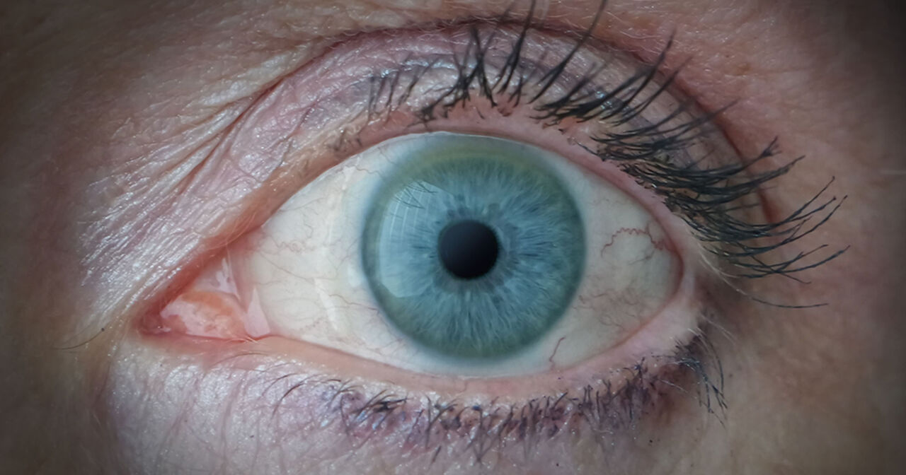 Auge
